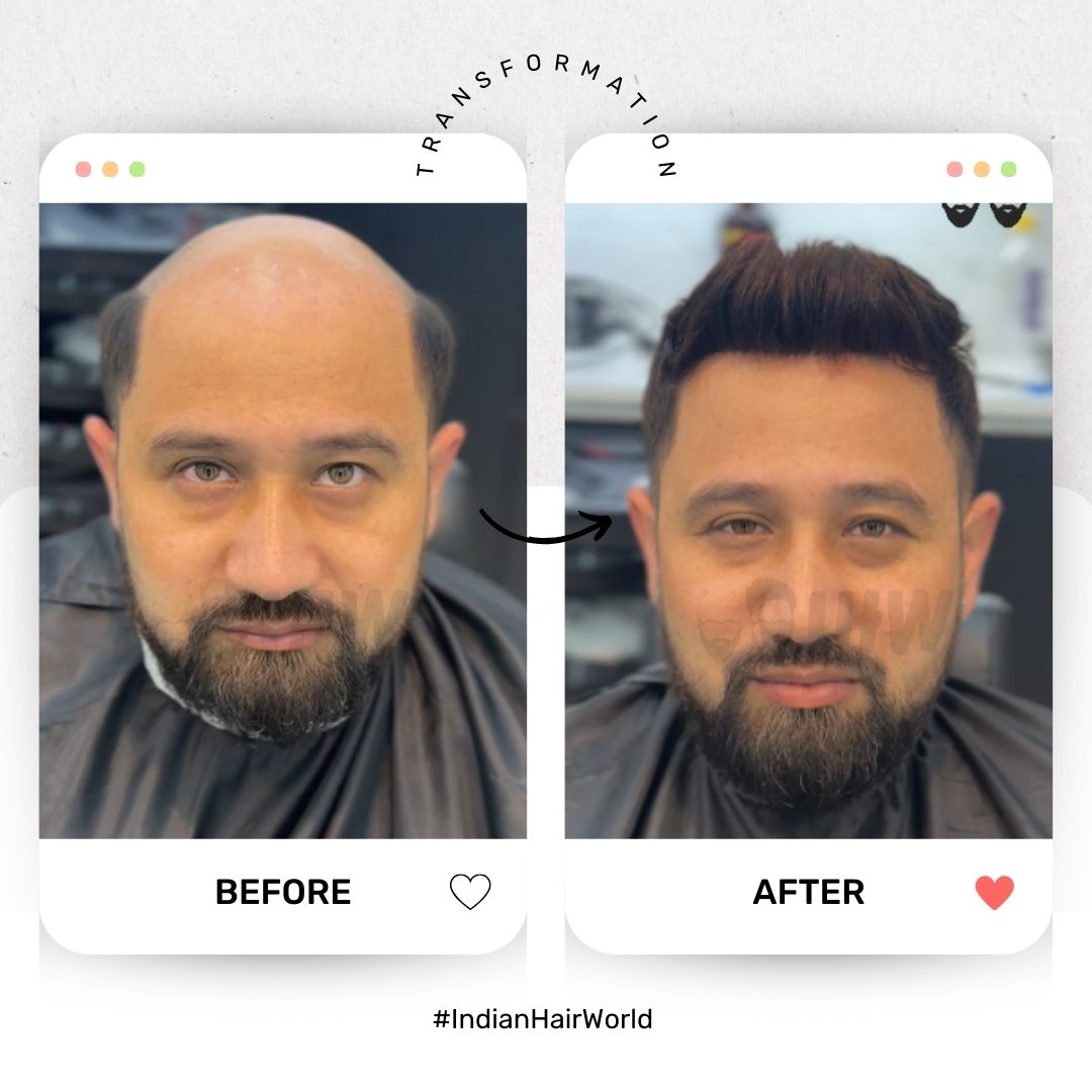 Transformation 2
