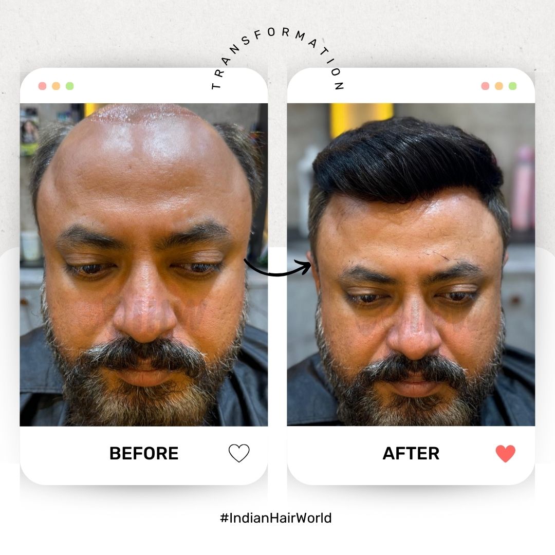 Transformation 1